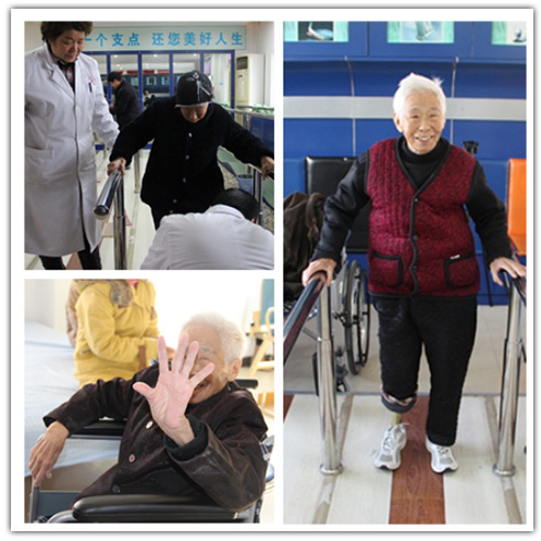 86岁小腿假肢安装案例，86岁老太站起来啦！！